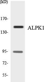 Western blot - Anti-ALPK1 antibody (AB135967)