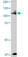Western blot - Anti-ALPK1 antibody (AB89140)