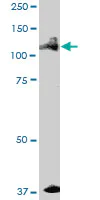 Western blot - Anti-ALPK1 antibody (AB89140)