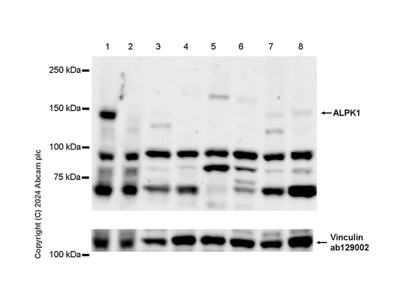 Western blot - Anti-ALPK1 antibody [EPR25006-61] - BSA and Azide free (AB317808)