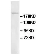 Western blot - Anti-ALPK2 antibody (AB111909)