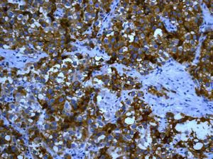 Immunohistochemistry (Formalin/PFA-fixed paraffin-embedded sections) - Anti-ALPP+ALPG+ALPI antibody [EPR6141] (AB133602)