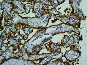Immunohistochemistry (Formalin/PFA-fixed paraffin-embedded sections) - Anti-ALPP+ALPG+ALPI antibody [EPR6141] (AB133602)