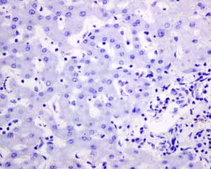 Immunohistochemistry (Formalin/PFA-fixed paraffin-embedded sections) - Anti-ALPP+ALPG+ALPI antibody [EPR6141] (AB133602)