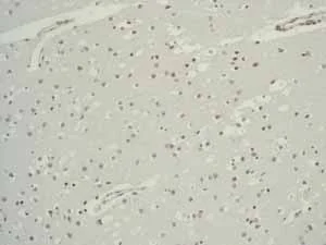 Immunohistochemistry (Formalin/PFA-fixed paraffin-embedded sections) - Anti-ALPP+ALPG+ALPI antibody [EPR6141] - BSA and Azide free (AB220315)
