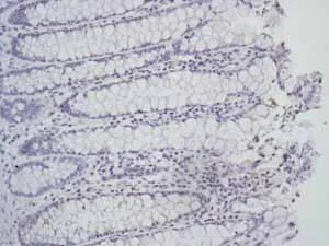 Immunohistochemistry (Formalin/PFA-fixed paraffin-embedded sections) - Anti-ALPP+ALPG+ALPI antibody [EPR6141] - BSA and Azide free (AB220315)