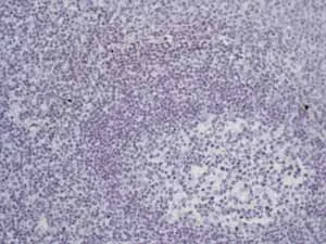 Immunohistochemistry (Formalin/PFA-fixed paraffin-embedded sections) - Anti-ALPP+ALPG+ALPI antibody [EPR6141] - BSA and Azide free (AB220315)