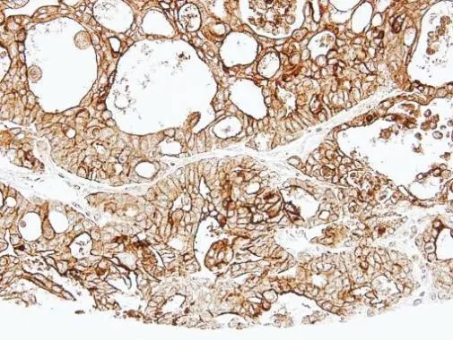 Immunohistochemistry (Formalin/PFA-fixed paraffin-embedded sections) - Anti-ALPPL2 antibody (AB96497), expandable thumbnail