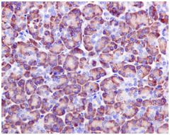 Anti-Als2 antibody [EPR11185]