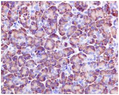 Immunohistochemistry (Formalin/PFA-fixed paraffin-embedded sections) - Anti-Als2 antibody [EPR11185] (AB170896)