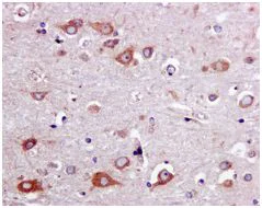 Immunohistochemistry (Formalin/PFA-fixed paraffin-embedded sections) - Anti-Als2 antibody [EPR11185] (AB170896)