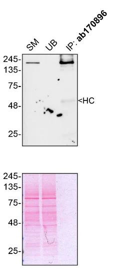 Immunoprecipitation - Anti-Als2 antibody [EPR11185] (AB170896)