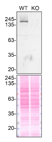 Western blot - Anti-Als2 antibody [EPR11185] (AB170896)