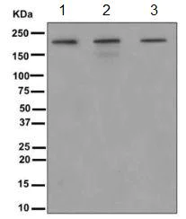 Western blot - Anti-Als2 antibody [EPR11185] (AB170896)