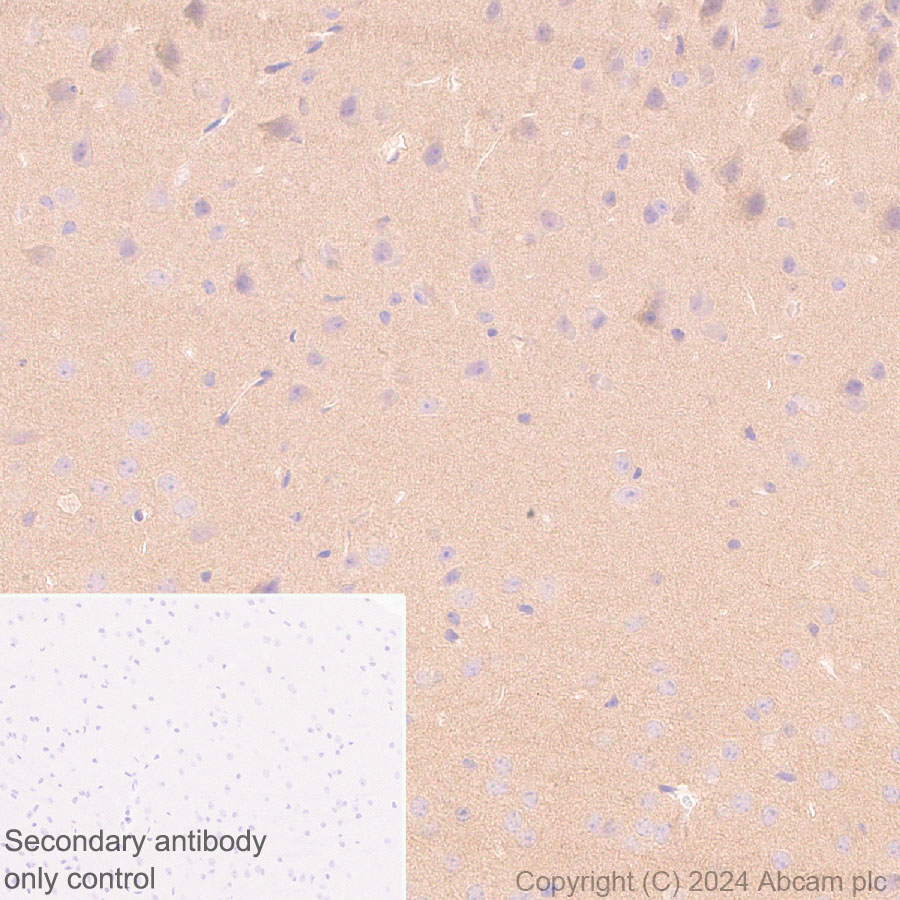 Immunohistochemistry (Formalin/PFA-fixed paraffin-embedded sections) - Anti-Als2 antibody [EPR27469-29] - BSA and Azide free (AB316196), expandable thumbnail