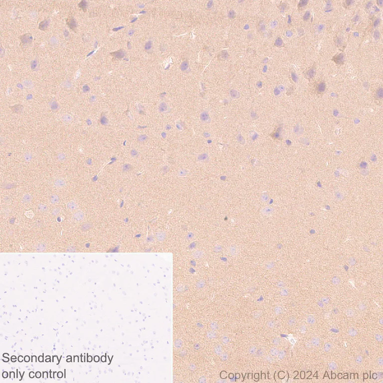 Immunohistochemistry (Formalin/PFA-fixed paraffin-embedded sections) - Anti-Als2 antibody [EPR27469-29] - BSA and Azide free (AB316196)