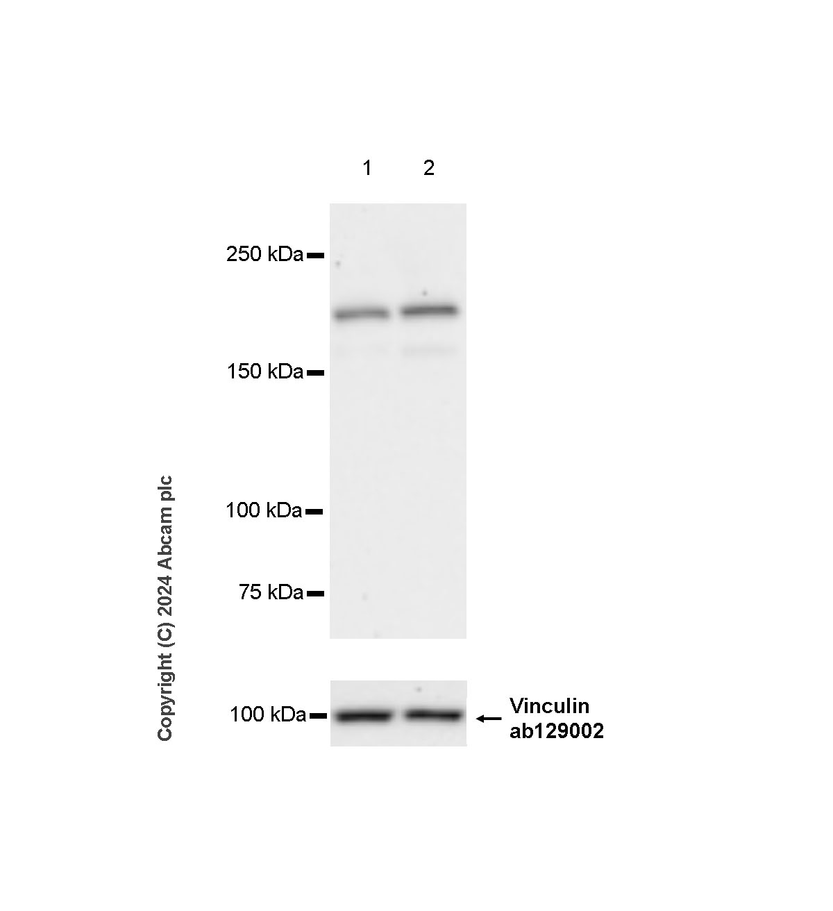 Western blot - Anti-Als2 antibody [EPR27469-29] - BSA and Azide free (AB316196), expandable thumbnail