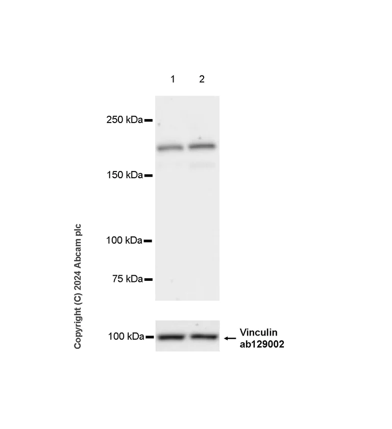 Western blot - Anti-Als2 antibody [EPR27469-29] - BSA and Azide free (AB316196)