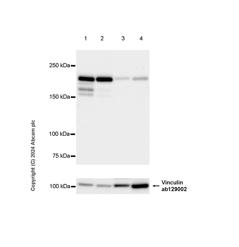 Western blot - Anti-Als2 antibody [EPR27469-29] - BSA and Azide free (AB316196)