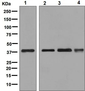 Western blot - Anti-ALS2CR1 antibody [EPR9335] - BSA and Azide free (AB248781)