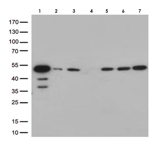 Western blot - Anti-ALS2CR7 antibody [OTI4H2] (AB279393), expandable thumbnail