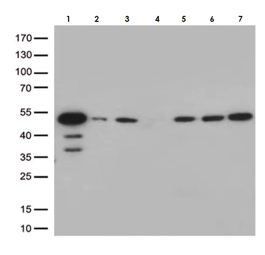 Western blot - Anti-ALS2CR7 antibody [OTI4H2] (AB279393)