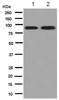 Western blot - Anti-ALS2CR8 antibody [EPR13712] - BSA and Azide free (AB250151)