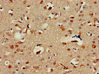 Immunohistochemistry (Formalin/PFA-fixed paraffin-embedded sections) - Anti-Alx1 antibody (AB234726), expandable thumbnail