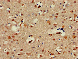Immunohistochemistry (Formalin/PFA-fixed paraffin-embedded sections) - Anti-Alx1 antibody (AB234726)