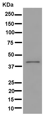 Western blot - Anti-Alx1 antibody [EPR11331] - BSA and Azide free (AB250348)