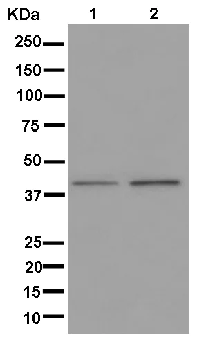 Western blot - Anti-Alx1 antibody [EPR11331] - BSA and Azide free (AB250348)
