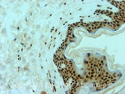 Immunohistochemistry (Formalin/PFA-fixed paraffin-embedded sections) - Anti-Aly/Ref antibody [11G5] (AB6141)