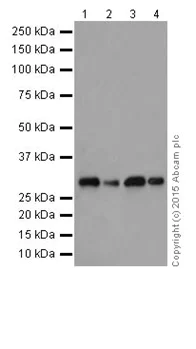 Western blot - Anti-Aly/Ref antibody [EPR17942] (AB202894)