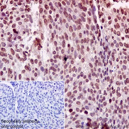 Immunohistochemistry (Formalin/PFA-fixed paraffin-embedded sections) - Anti-Aly/Ref antibody [EPR17942] - BSA and Azide free (AB240364)