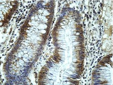 Immunohistochemistry (Formalin/PFA-fixed paraffin-embedded sections) - Anti-AMACO antibody (AB177103)