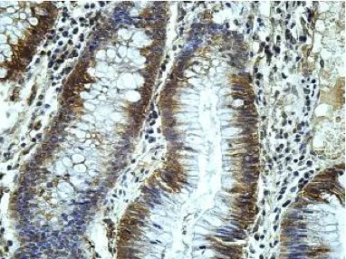 Immunohistochemistry (Formalin/PFA-fixed paraffin-embedded sections) - Anti-AMACO antibody (AB177103)