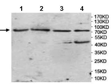 Western blot - Anti-AMACO antibody (AB177103)