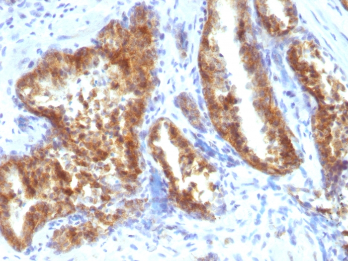 Immunohistochemistry (Formalin/PFA-fixed paraffin-embedded sections) - Anti-AMACR antibody (AB194396), expandable thumbnail
