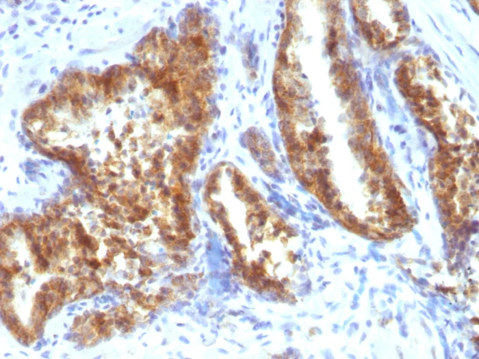 Immunohistochemistry (Formalin/PFA-fixed paraffin-embedded sections) - Anti-AMACR antibody (AB194396)