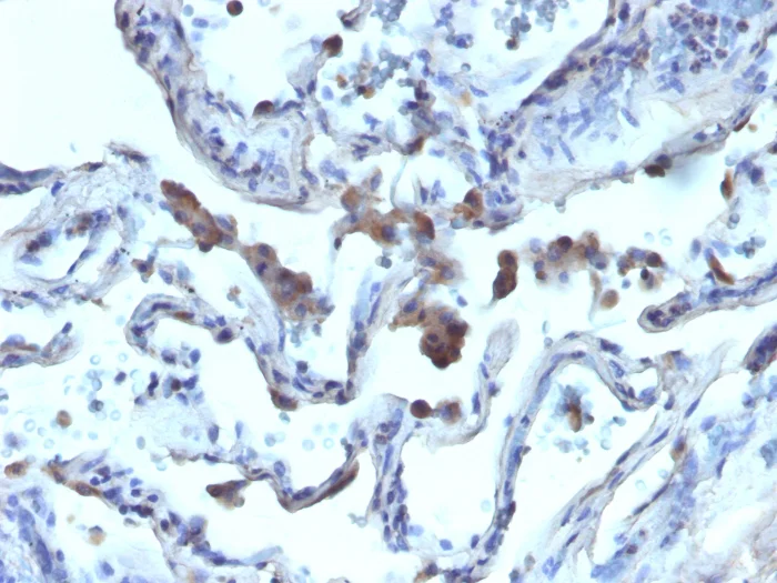 Immunohistochemistry (Formalin/PFA-fixed paraffin-embedded sections) - Anti-AMACR antibody (AB194396)