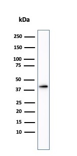 Western blot - Anti-AMACR antibody (AB194396), expandable thumbnail