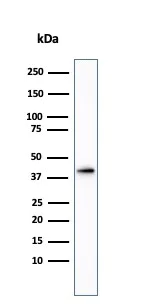 Western blot - Anti-AMACR antibody (AB194396)