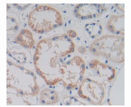 Immunohistochemistry (Formalin/PFA-fixed paraffin-embedded sections) - Anti-AMACR antibody (AB231333)