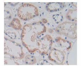 Immunohistochemistry (Formalin/PFA-fixed paraffin-embedded sections) - Anti-AMACR antibody (AB231333)