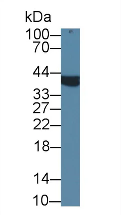 Western blot - Anti-AMACR antibody (AB231333)