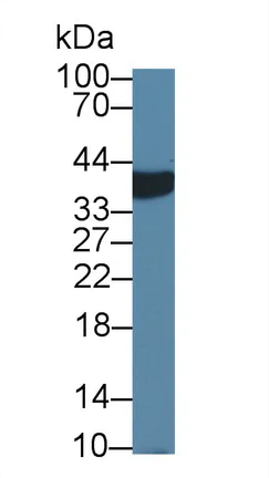 Western blot - Anti-AMACR antibody (AB231333)