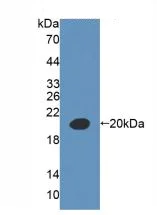Western blot - Anti-AMACR antibody (AB231333)