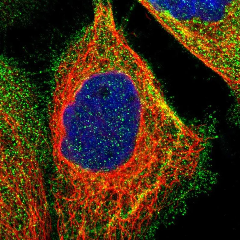 Immunocytochemistry/ Immunofluorescence - Anti-AMACR antibody (AB246927)