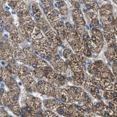 Immunohistochemistry (Formalin/PFA-fixed paraffin-embedded sections) - Anti-AMACR antibody (AB246927)