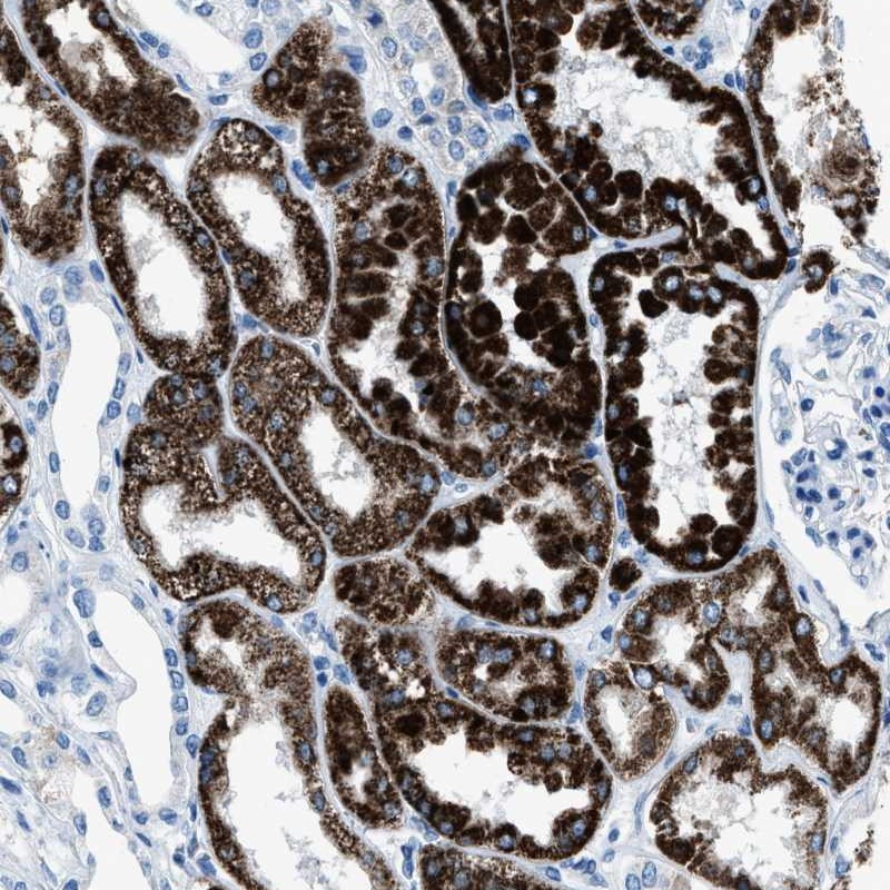 Immunohistochemistry (Formalin/PFA-fixed paraffin-embedded sections) - Anti-AMACR antibody (AB246927)
